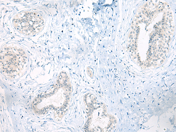 ARHGAP45 Antibody