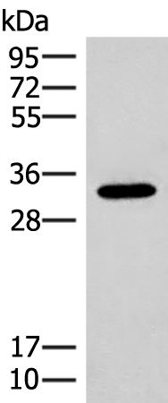 PAIP2 Antibody