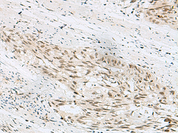 HELT Antibody