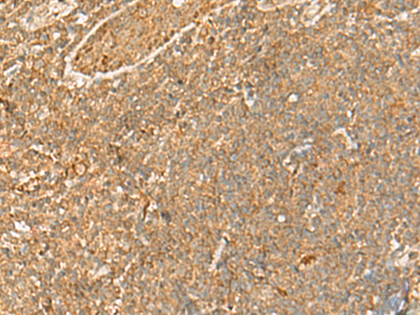 H1FOO Antibody