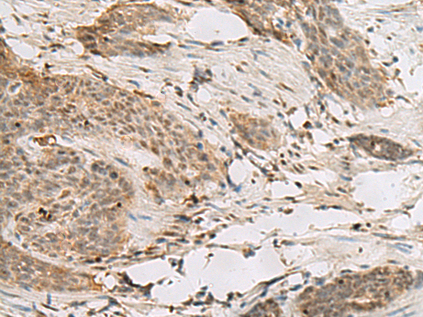H1FOO Antibody