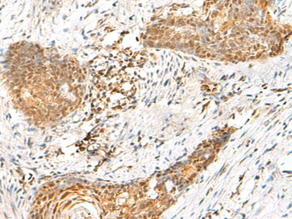HMBOX1 Antibody