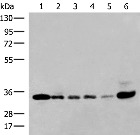 HMBOX1 Antibody