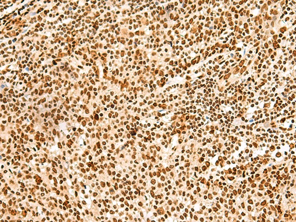 HNRNPA3 Antibody