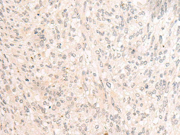HBB Antibody