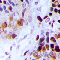 Adenylate Kinase 6 Antibody