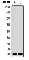 Adenylate Kinase 6 Antibody