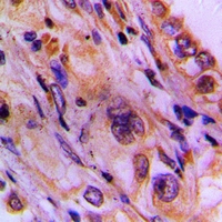 CEP78 Antibody