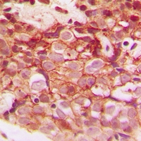 CLIP3 Antibody