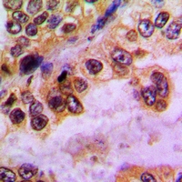 GABRD Antibody
