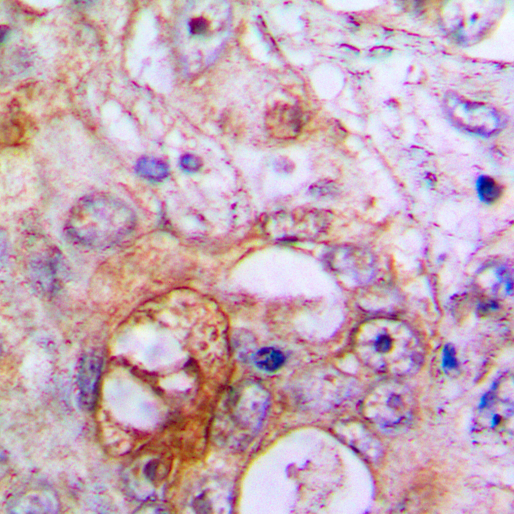RSAD2 Antibody
