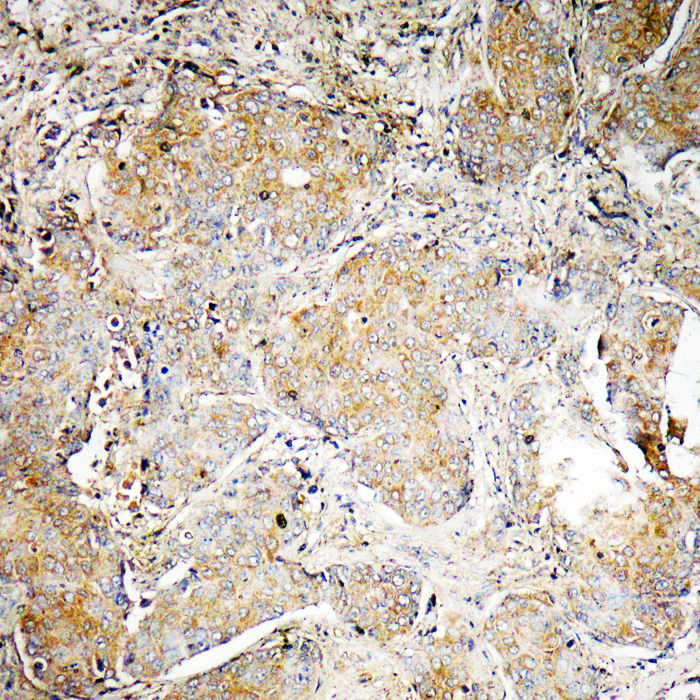 LEKTI Antibody