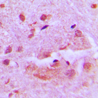 SHARP1 Antibody