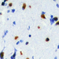 SRSF5 Antibody