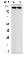 Myosin-pan (acetyl-Lys505) Antibody