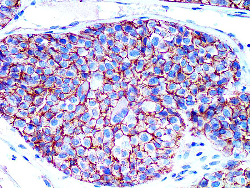 KBA.62 (Melanoma Associated Antigen) Antibody