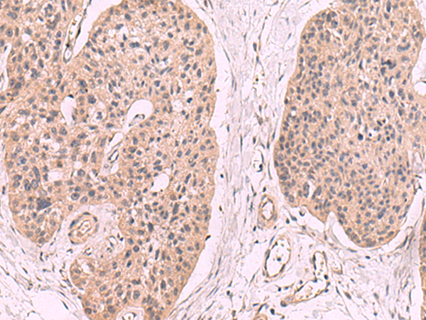 KLRB1 Antibody