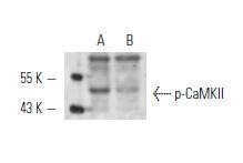 CaMKII (Phospho-Thr 286) Antibody