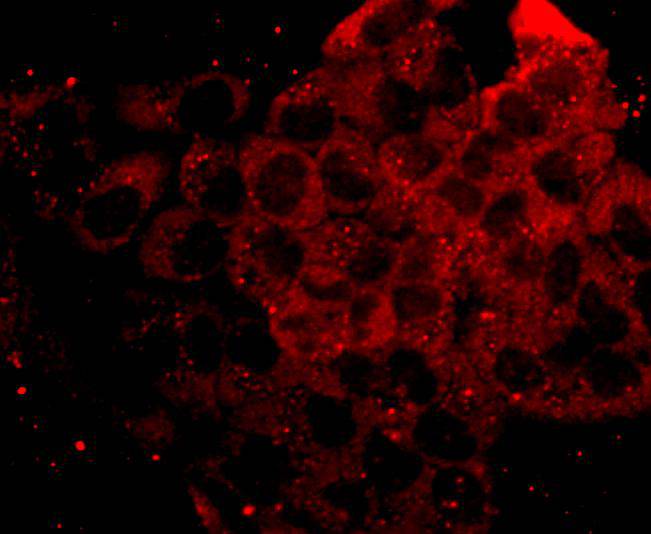 p70 S6 Kinase (Phospho-Ser 411) Antibody