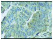 PKR (Phospho-Thr446) Antibody