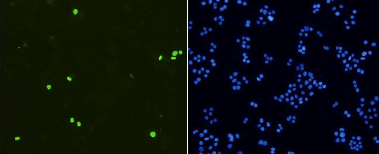 Phospho-Histone H3(S10) Rabbit mAb