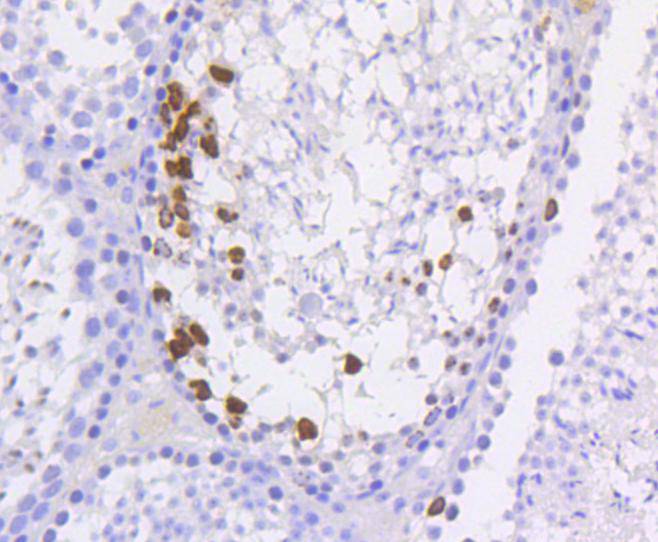Phospho-Histone H3(S10) Rabbit mAb