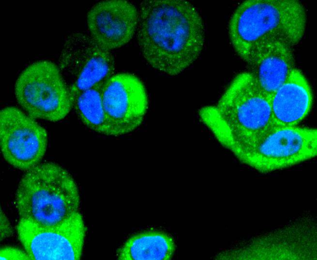 Phospho-Erk1(T202)+Erk2(T185) Rabbit mAb