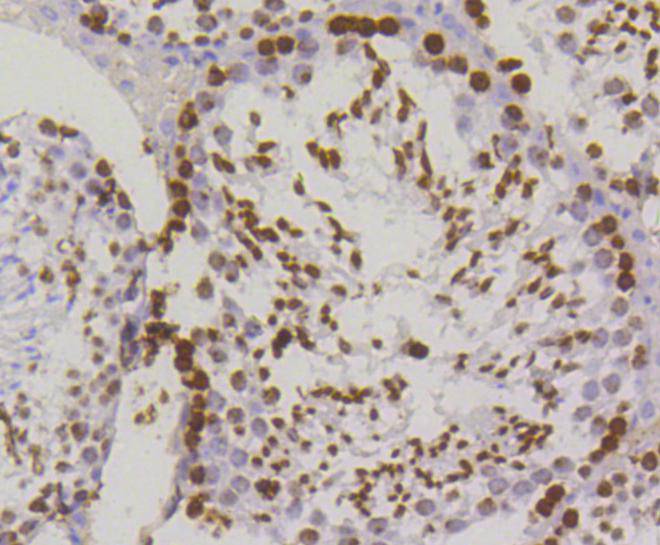 Phospho-Histone H2A.X(S139) Rabbit mAb