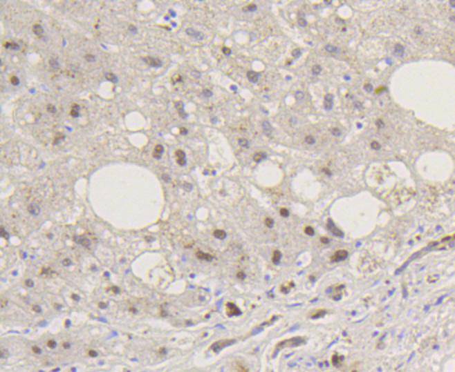 Phospho-Smad5(S463/465) Rabbit mAb