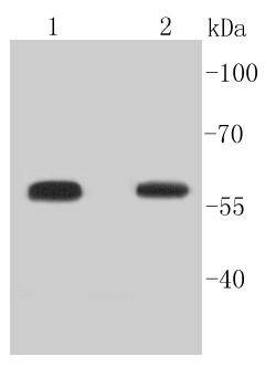 Phospho-Smad5(S463/465) Rabbit mAb