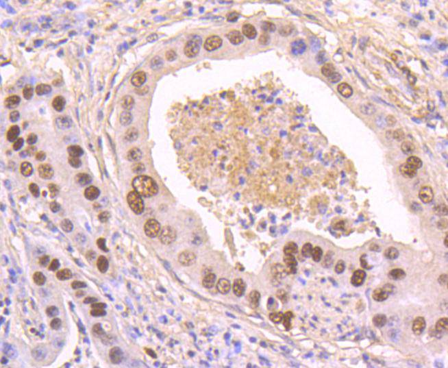 Phospho-p53(S392) Rabbit mAb
