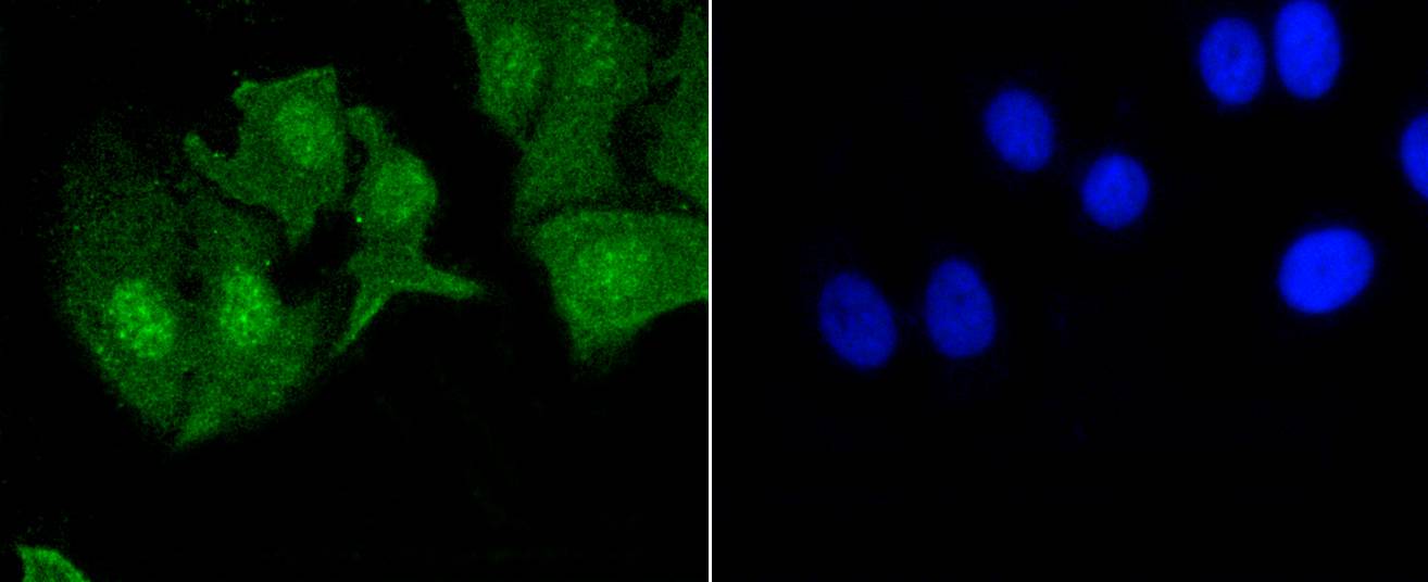 Phospho-EGFR(Y1092) Rabbit mAb
