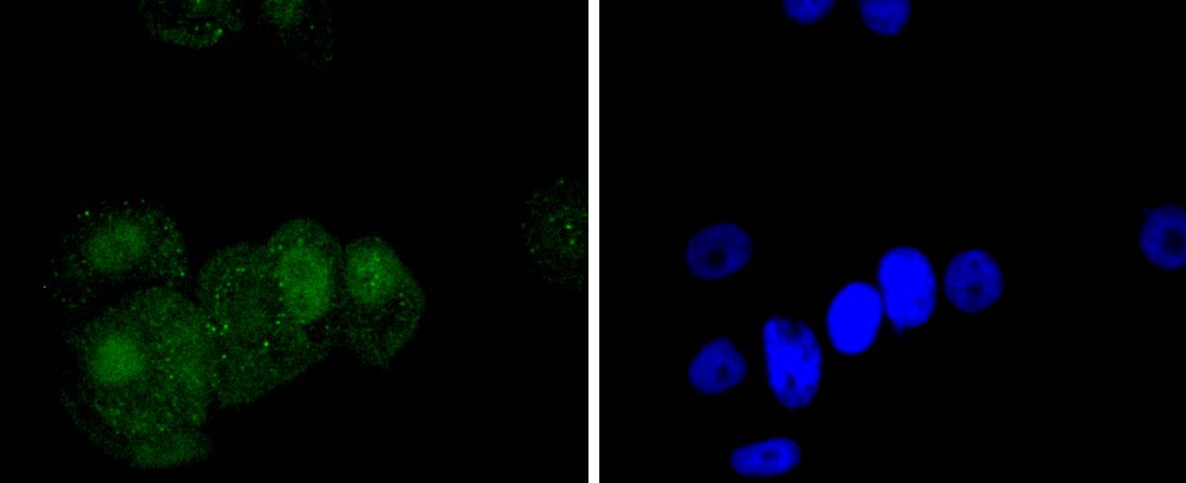 Phospho-c-Jun(S63) Rabbit mAb