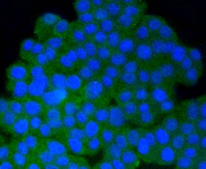 Phospho-PP2A(Y307) Rabbit mAb