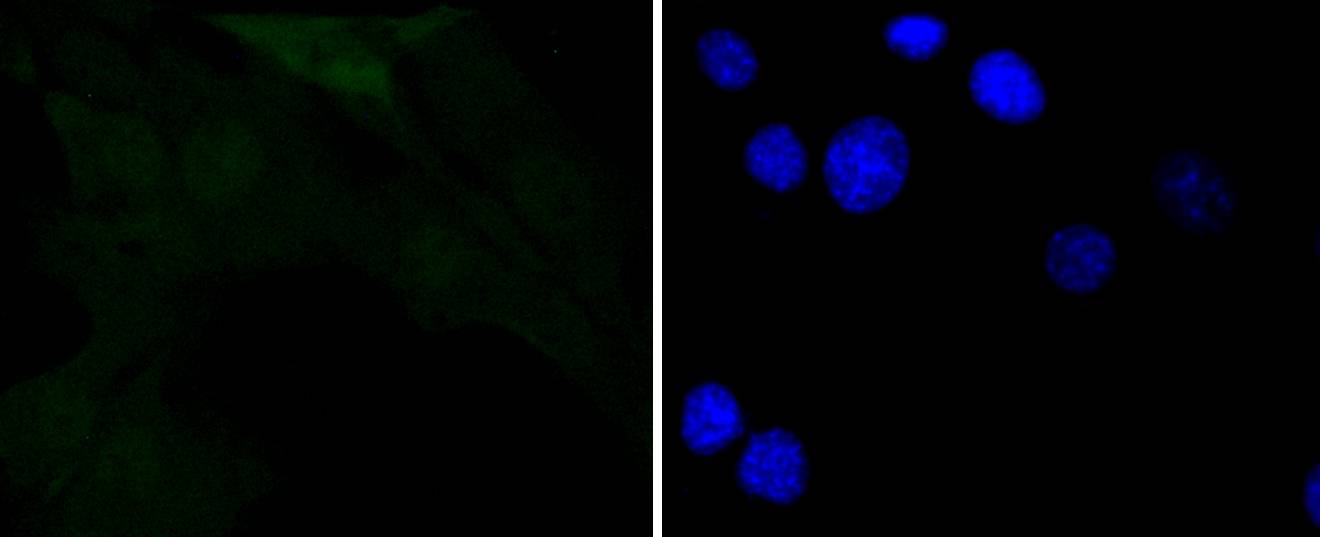 Phospho-IKB alpha(S32) Rabbit mAb