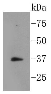 Phospho-IKB alpha(S32) Rabbit mAb