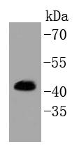 Erk1(pT202/pY204)+Erk2(pT185/pY187) Rabbit mAb
