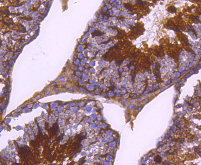 Phospho-PKA R2 (S99) Rabbit mAb