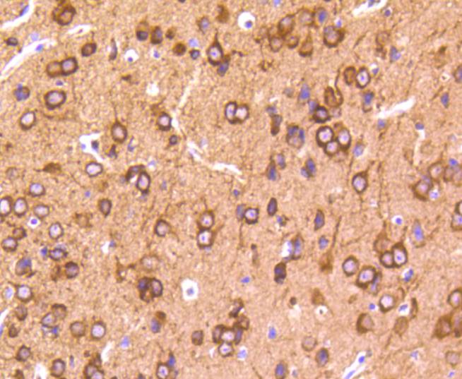 Phospho-Tau(T231) Rabbit mAb
