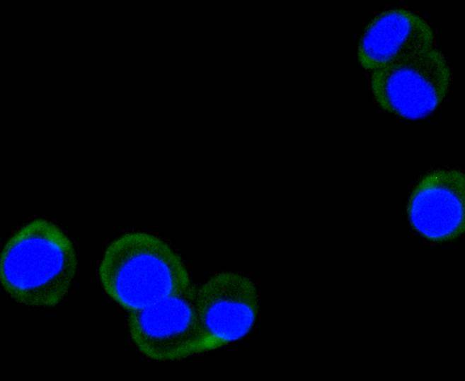 Phospho-FAK (Y397) Rabbit mAb