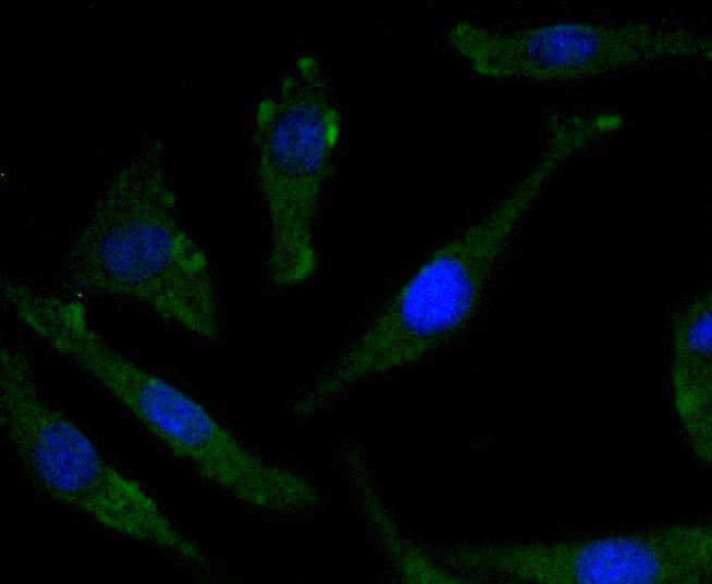 Phospho-TrkB(Y817) Rabbit mAb