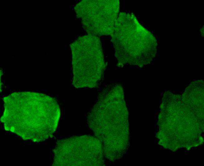 Phospho-EGFR (pY1173) Rabbit mAb