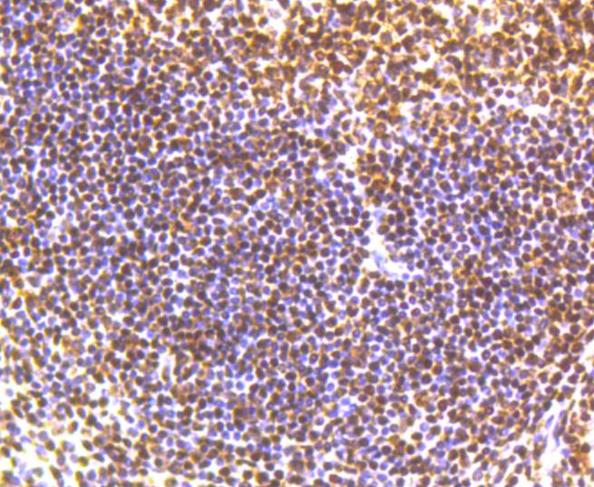 Phospho-SMC1(S957) Rabbit mAb