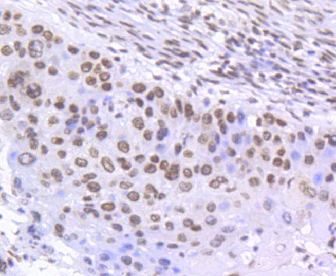 Phospho-SMC1(S957) Rabbit mAb