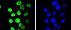 MSK1(phospho S376) Rabbit mAb
