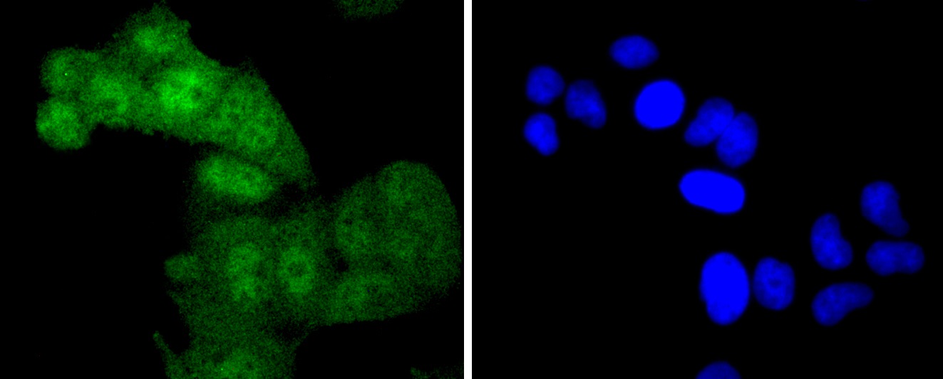 Phospho-c-Myc(T58) Rabbit mAb