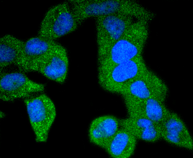PDGF Receptor beta(phospho Y740) Rabbit mAb
