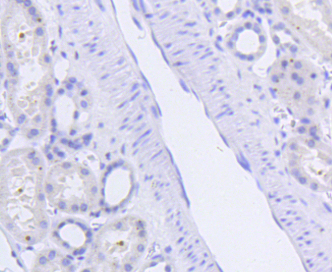 SIRT1(phospho S47) Rabbit mAb