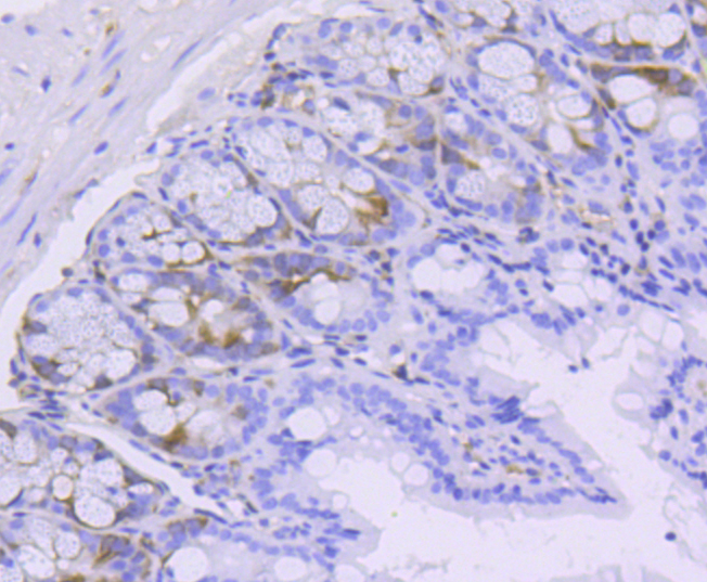 Phospho-Cdk2(Y15) Rabbit mAb