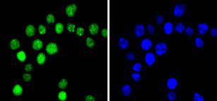 Phospho-Cyclin E1(T77) Rabbit mAb
